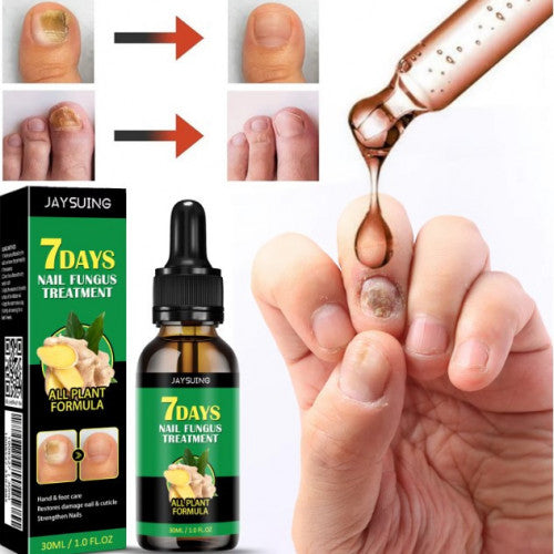 Serum para Hongos en Uñas – Pies y Manos (30 ml)